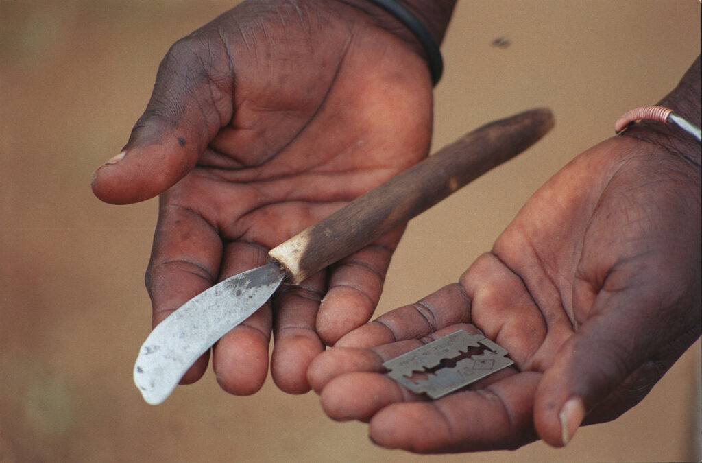 Female Genital Mutilation